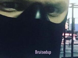 Bruisedup